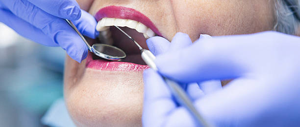 Best Emergency Cosmetic Dentistry (e.g., broken veneers) in Gibsonburg, OH